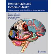 Hemorrhagic and Ischemic Stroke : Medical, Imaging, Surgical..., 9781604062342
