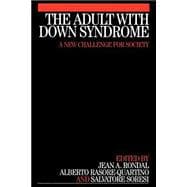 Adult with Down Syndrome : A New Challenge for Society