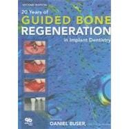 20 Years of Guided Bone Regeneration in Implant Dentistry, 9780867154016