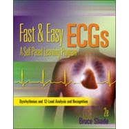 Pocket Guide for Fast and Easy Ecgs,9780077394028 Pocket Guide for Fast and Easy Ecgs,9780077394028