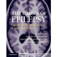 The Causes of Epilepsy: Common and Uncommon Causes in Adults..., 9780521114479