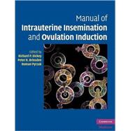 Manual of Intrauterine Insemination and Ovulation Induction, 9780521735629