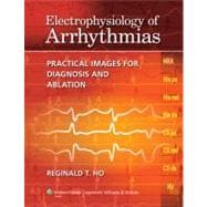 Electrophysiology of Arrhythmias Practical Images for Diagno..., 9781605475905