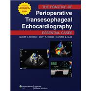The Practice of Perioperative Transesophageal Echocardiograp..., 9781605477169