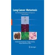 Lung Cancer Metastasis : Novel Biological Mechanisms and Imp..., 9781441907714