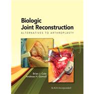 Biologic Joint Reconstruction : Alternatives to Joint Arthro..., 9781556428500