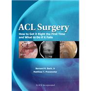 ACL Surgery : How to Get It Right the First Time and What to..., 9781556428951