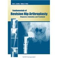 Fundamentals of Revision Hip Arthroplasty : Diagnosis, Evalu..., 9781556429521